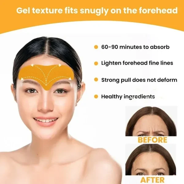 The Forehead Wrinkle Patch Can Lift The Face And Tighten The Skin The Forehead Patch Can Fade And Smooth The Forehead Wrinkles - Image 4